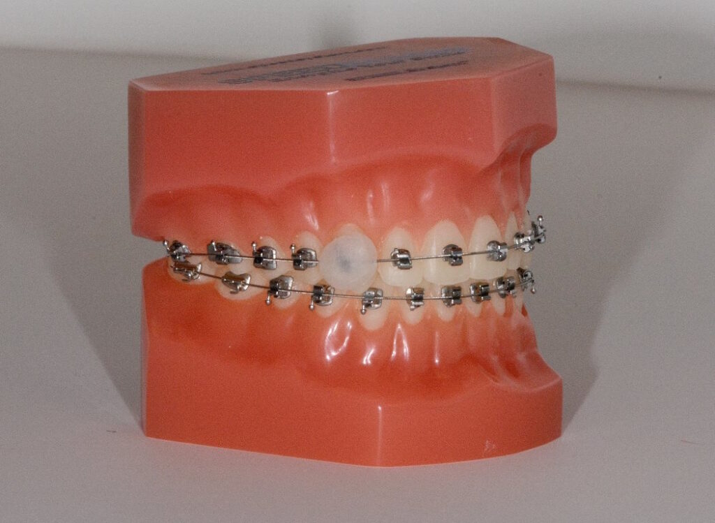 Druckstelle